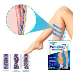 GENERICO - Parche Médico Chino para Tratamiento de Venas Varicosas