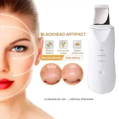 GENERICO - Peeling Ultrasónico Limpieza Lifting Facial