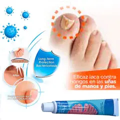GENERICO - Crema para Eliminar Hongos en Uñas de Pies y Manos