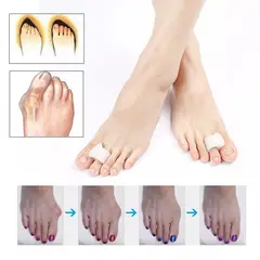 GENERICO - Separador de dedos, Corrector De dedos , 1 Par