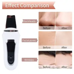 GENERICO - Limpiador Facial Espátula Ultrasónico Limpieza Profunda 4 Modos