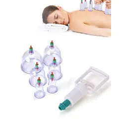 GENERICO - Ventosas Chinas Vacumterapia Acupuntra 6pcs