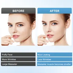 TIOZONEY - Dispositivo de adelgazamiento facial por vibración de microcorriente