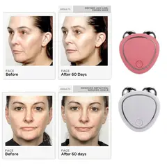 GENERICO - Masajeador para Rostro con Microcorriente - Color Variado