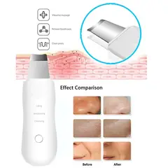 OEM - Limpiador Facial Espátula Ultrasónico Limpieza Profunda Portatil