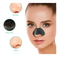 GENERICO - 10 Mascarilla para Eliminar Espinillas y puntos negros en la nariz