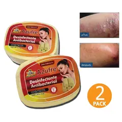 GENERICO - Jabon De Azufre Para Psoriasis, dermatitis 2 und