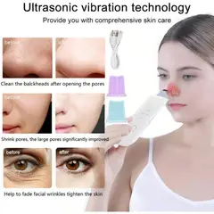 OEM - Limpiador facial espátula quita espinillas ULTRASONIDO