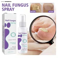 GENERICO - Spray Para los Hongos En Las Uñas Medinail de 30ml