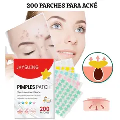 OEM - 200 Parches ANTI ACNÉ - ESPINILLAS de Hidrocoloides en Estrella