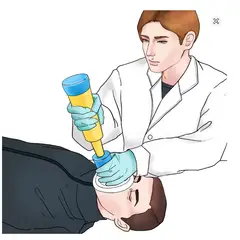 GENERICO - Kit de Emergencia Anti Asfixia Anti Atragantamiento