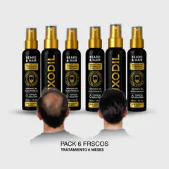 GENERICO - 6 Luxodil - Minoxidil 10% + Dutasteride 01% - Spray 60 ml
