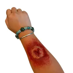 GENERICO - Herida abierta - La Casa de las Bromas