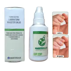 GENERICO - Terbinafina Gotas para hongos en las uñas y pies