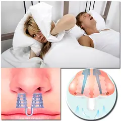 GENERICO - Clip Antironquidos Para evitar Roncar y Dormir sin problemas - 4 Unidades