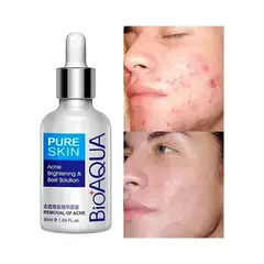 BIOAQUA - Serum Aclarante Pure Skin -