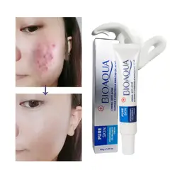 BIOAQUA - Crema Removedor de Acné Linea Pure Skin -