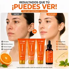 GENERICO - Kit Completo de Cuidado Facial con Acido Mándelico y Niacinamida para Aclarar Manchas - Dermachem