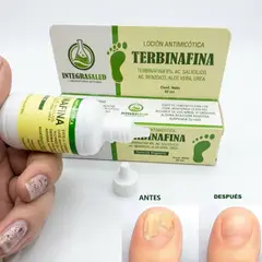 GENERICO - 2 Terbinafina s 8% en Gotas para Tratamiento de Hongos en las Uñas y Pies