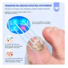 GENERICO - Laser Para Quitar Hongos De Las Uñas Elimina Onicomicosis